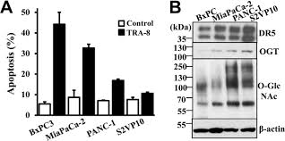 It is so very hard. Regulation Of Pancreatic Cancer Trail Resistance By Protein O Glcnacylation Laboratory Investigation
