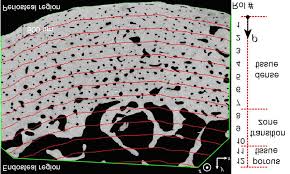 Whereas a long bone has only one layer of compact bone (see fig 1). Cross Section Of Chicken Bone What Is A Stress Fracture Part 1 Of 2 Stay Safe Not Only Are They A Little Less Expensive Than Braising