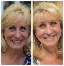 Another HFCC Past Pupil making a difference!