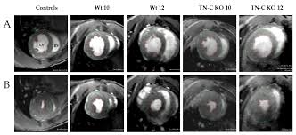 Ada yang berkereta ada yang jalan saja. Ijms Free Full Text The Role Of Tenascin C In Cardiac Reverse Remodeling Following Banding Debanding Of The Ascending Aorta Html