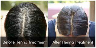 The henna dye coats the hair, instead of soaking into the stands themselves. 8 Grey Hair Ideas Henna Hair Grey Hair Dye Henna Hair Dyes