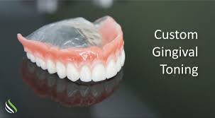 I had it, as well as many others, and it's very normal. Aesthetics Dentures Option Gingival Toning And Clear Acrylic Woodside Denture Centre