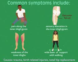 Image result for Obturator Sign