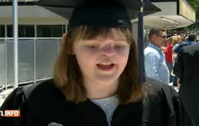 La leçon de courage d'une jeune femme née sans yeux ni nez