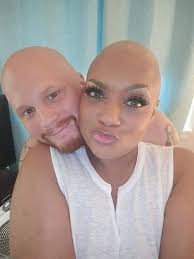 Beautiful Bald Woman Receives Admiration