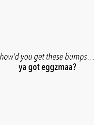So You Just Gonna Bring Me A Birthday Gift Words Howd You Get These Bumps Ya Got Eggzmaa Vine Quote Sticker By Ayeebella In 2020 Vine Quote Quote Stickers Vine Memes