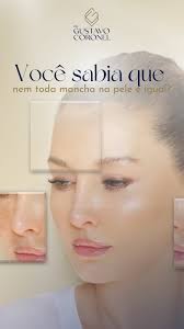 🔍Você sabia que nem toda mancha na pele é igual?, Manchas podem ser  causadas por diversos fatores, como:, ✔️Exposição solar sem proteção.,  ✔️Alterações hormonais., ✔️Uso inadequado de produtos., ...