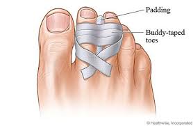 A Z Index Page Primping And Pampering Broken Toe Fractured Toe Sprain