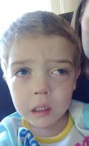 Bennett Messer's Journey with Neurofibromatosis and Embryonal  Rhabdomyosarcoma