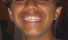 Escribe Léxico: Bruno Ybarra (2)