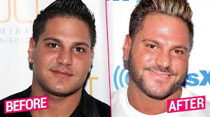 Find out which plastic surgery procedures are performed most often. Jersey Shore Cast S Shocking Plastic Surgery Transformations Revealed