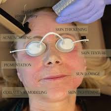 Tanya Weeks__Esthetician, Laser Technician