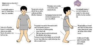 A disorder usually caused by brain damage occurring at or before birth and marked by muscular impairment. Cerebral Palsy The Symptoms Enorev