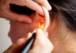 Benjolan di belakang telinga disebabkan oleh banyak hal. Ketahui Tanda Tanda Awal Masalah Kurang Pendengaran Yang Terjadi Pada Orang Muda