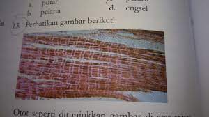 Otak tengah adalah pusat pengatur gerakan otot mata,. Perhatikan Gambar Diatas Otot Seperti Ditunjukkan Gambar Di Atas Antara Lain Ditemukan Brainly Co Id