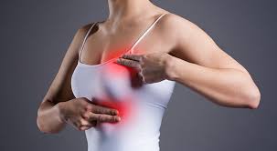 A new mass or lump in breast tissue is the most common sign of breast cancer. Are There Other Signs Of Breast Cancer Norton Healthcare Louisville Ky
