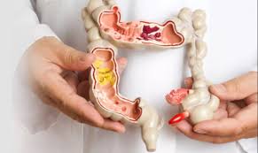 Colon and rectal surgery
