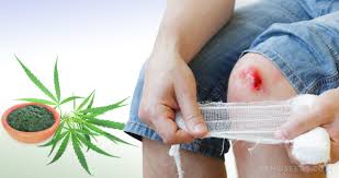 Even small, nearly invisible hairs on cacti can be strong enough to puncture skin. Does Cannabis Help Heal Wounds And Injuries Faster Sensi Seeds