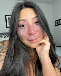 This past week I was feeling lost and defeated. Today I'm feeling strong  and confident. I looked into the mirror today and really felt the beauty of  my birthmark( I will always