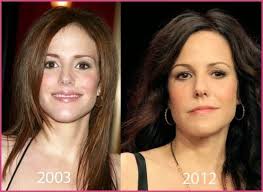 Pin On Face Lift