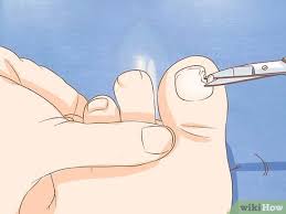 If you have a toenail that's been battered, bruised or hit by nail fungus, you need time to let it grow back strong and healthy. How To Help A Toenail Grow Back Quickly 15 Steps With Pictures