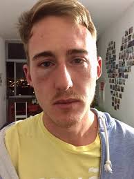 Certeza que foi homofobia', diz americano que denuncia caso de agressão em  BH