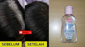 Ia diformulasi khas untuk memulihkan rambut. Cara Cepat Menghilangkan Uban Hasil Permanen Selamanya Youtube
