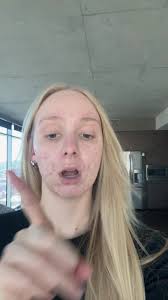 Jolie Shower Filter: Transform Your Skin Health