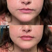 𝘕𝘪𝘬𝘬𝘪” 𝘊𝘩𝘳𝘪𝘴𝘵𝘪𝘯𝘢 𝘕𝘪𝘤𝘰𝘭𝘦 𝘌𝘷𝘢𝘯𝘴  (@nursenikki_aesthetics) • Instagram photos and videos