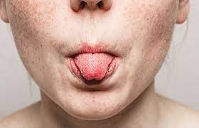 Zunge 10 Dinge Die Sie Uber Die Gesundheit Verrat Minimed At