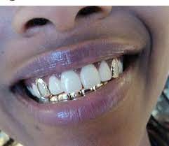 10k Gold Teeth Top 2 Bottom 6 Grillz Teeth Gold Teeth Teeth Jewelry
