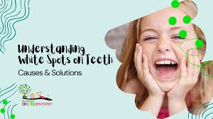 Understanding White Spots