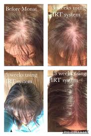 Pin By Bridget Mailloux On Monat Testimonies Hair Loss Treatment Monat Hair Loss Hair Loss Shampoo