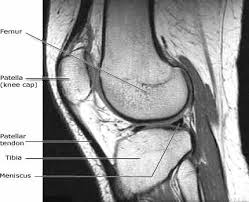 For a knee mri, you'll go in feet first, and only your lower body will be in the tube. Body Mri Magnetic Resonance Imaging Of The Chest Abdomen And Pelvis