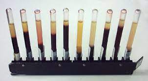 La vitesse de sédimentation (méthode de westergren). Vitesse De Sedimentation Wikipedia