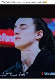 Humorous discussion about a woman's knee cap appearance