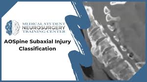 Image result for Subaxial Injury Classification Scale