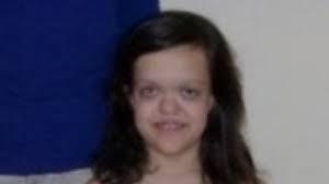 Teenager has hole burned into head by hairdresser who asked her to pay