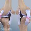 Medial collateral ligament knee anatomy. 1