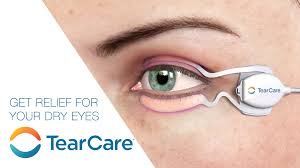 Image result for Dry Eye