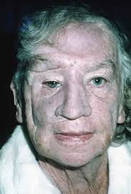 Plastic Surgical Dental