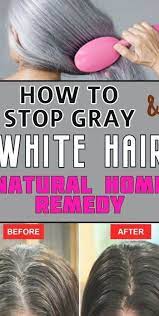 Grey hair is a combination of normally pigmented hairs interspersed with white ones. One Remedy To Get Rid Of Premature Grey Hair Home Remedy For White Hairs Remedy For White Hair Grey Hair Home Remedies Home Remedies For Hair