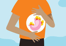 It happens when stomach contents flow back up (reflux) into the food pipe (esophagus). What S The Difference Between Heartburn Acid Reflux And Gerd Health Essentials From Cleveland Clinic