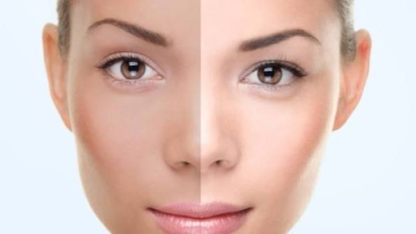 How to Remove Skin Tan Naturally: 7 Home Remedies to Remove Sun Tan