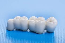 Check spelling or type a new query. How Many Teeth Can Dental Bridges Replace
