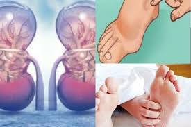 Saat terserang penyakit, ikan cupang menunjukkan berbagai tanda, mulai dari kelesuan sampai bercak putih. Bukan Sakit Pinggang Ini 4 Tanda Penyakit Ginjal Yang Sering Tak Disadari Semua Halaman Nakita