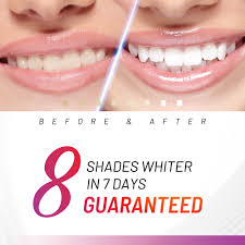 Subito a casa e in tutta sicurezza con ebay! Accelerator Teeth Whitening Kit White Glo