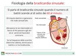 Che cosa è l'aritmia sinusale? Bradicardia Sinusale Cause Cura Rischi E Tipi