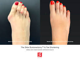 Some possible problems after surgery Our Blog Foot First Podiatry Centers