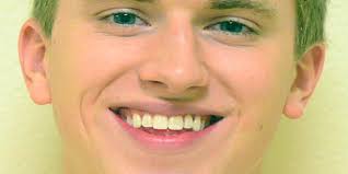 Switching paths leads Young to Austin Peay